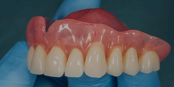 Image of Dentures