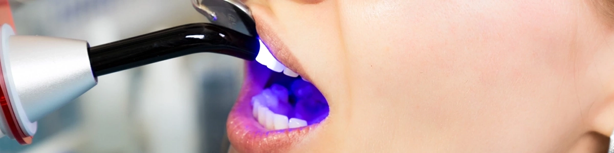 Image of woman undergoing Teeth Whitening